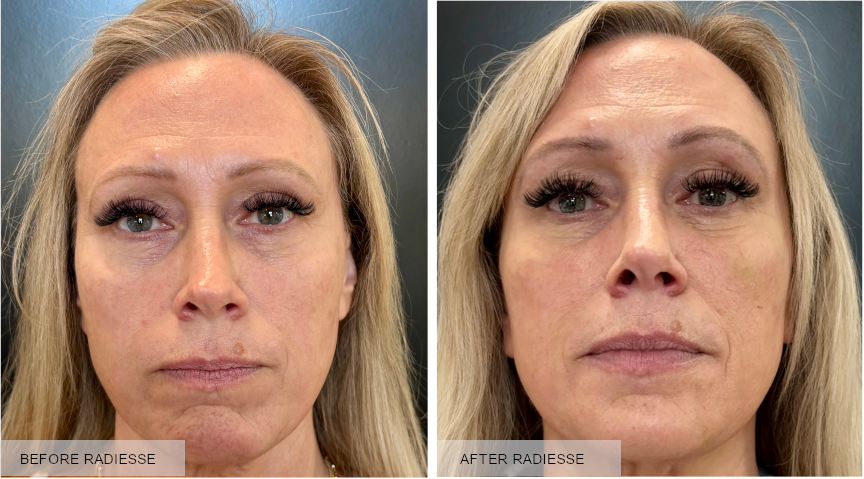 Before after2