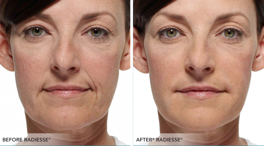 Before after3